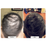 1+1 GRATIS | The HairGrower ™